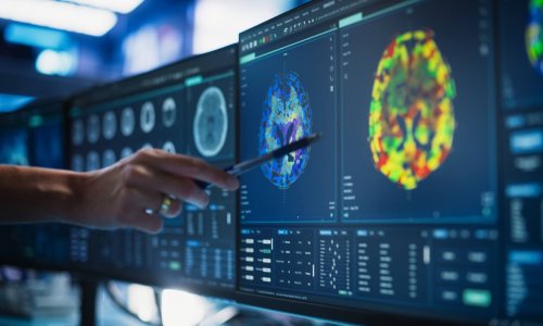 Modern Medical Research Center: Anonymous Doctor Pointing At Desktop Computer Monitor With CT Scan Of Patient's Spinal Cord. Specialist Looking For Tumors Or Damage, Looking For Treatment Methods.